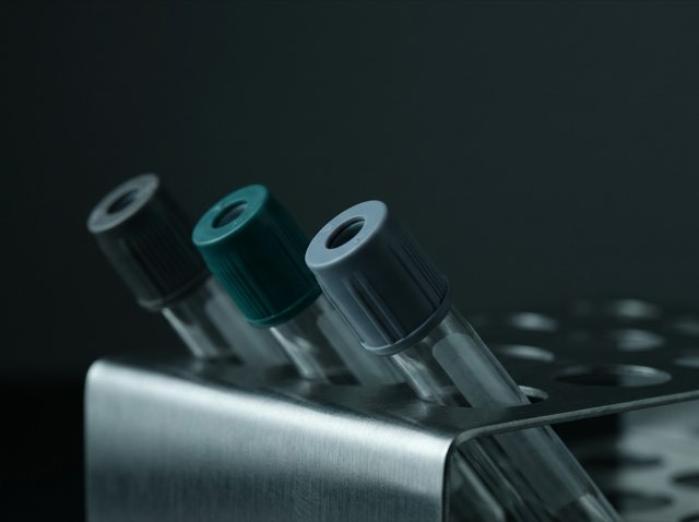 Capped blood-collection tubes standing in a brushed stainless rack, shot close and low against a dark background